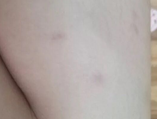乐婴泉紫草膏孕妇能用吗 乐婴泉紫草膏效果怎么样