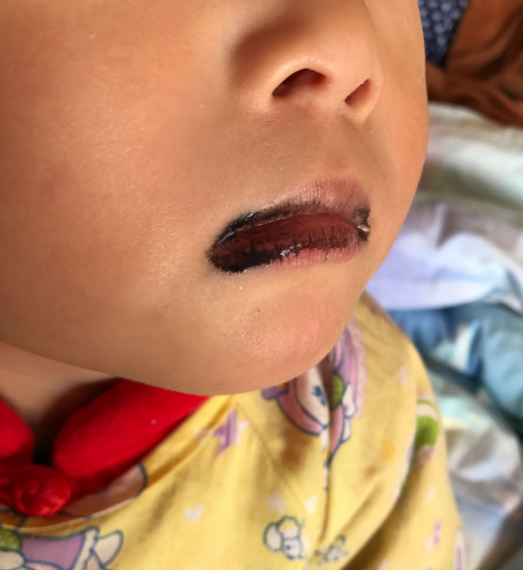 蜜牙贝贝补铁软胶囊卫生吗 蜜牙贝贝补铁软胶囊补铁效果怎么样 蜜牙贝贝补铁软胶囊卫生吗 蜜牙贝贝补铁软胶囊补铁效果怎么样