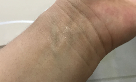 Aerogard驱蚊液几个月宝宝能用 Aerogard驱蚊液成分有酒精吗