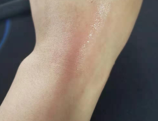 ALOBABY驱蚊水怎么样 ALOBABY驱蚊水使用测评