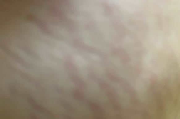 Pregnacares妊娠纹修复乳怎么样 Pregnacares妊娠纹修复乳试用测评 Pregnacares妊娠纹修复乳怎么样 Pregnacares妊娠纹修复乳试用测评