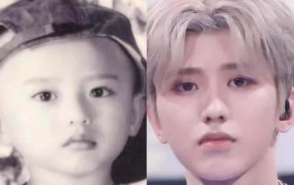 蔡徐坤的下巴是不是整容了 蔡徐坤过去是宽下巴吗 蔡徐坤的下巴是不是整容了 蔡徐坤过去是宽下巴吗