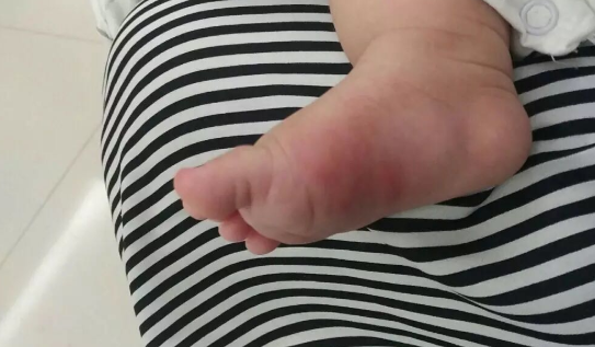 乐婴泉紫草膏孕妇能用吗 乐婴泉紫草膏效果怎么样
