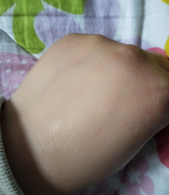 御方宝贝植物护臀膏油不油 御方宝贝植物护臀膏好不好