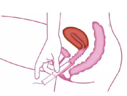 卫生棉条和卫生巾哪个好用 卫生棉条会影响处女膜吗