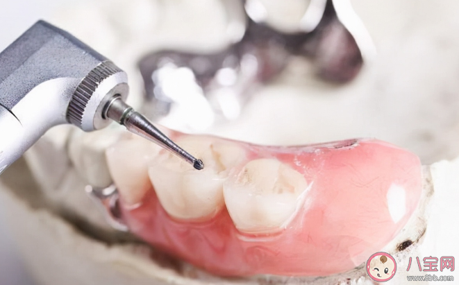 种植牙万元时代即将结束是真的吗 种植牙要降价了吗 种植牙万元时代即将结束是真的吗 种植牙要降价了吗