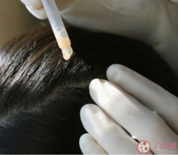 防脱发洗发水能改善脱发吗 洗发水主要作用是什么 防脱发洗发水能改善脱发吗 洗发水主要作用是什么