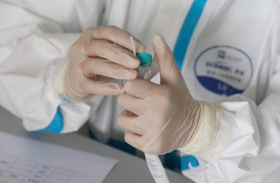 取核酸检测结果需要带医保卡吗1