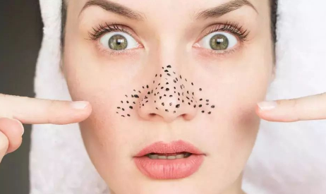 黑头挤出来了留下一个洞怎么办1