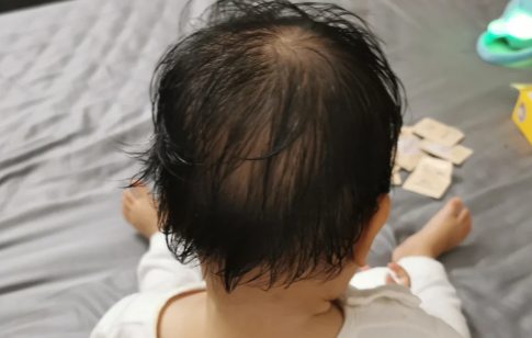 小孩反复高烧39度吃奥司他韦可以吗2