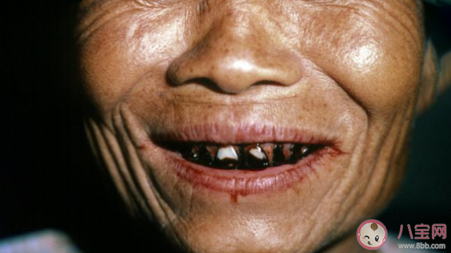 有说法称长期吃槟榔有可能致癌是真的吗 蚂蚁庄园10月23日答案解析