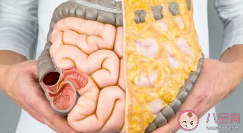 皮下脂肪怎么减最有效 什么运动减皮下脂肪最快